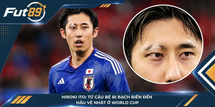 Hiroki Ito: Từ Cậu Bé Bị Bạch Biến Đến Hậu Vệ Nhật Ở World Cup